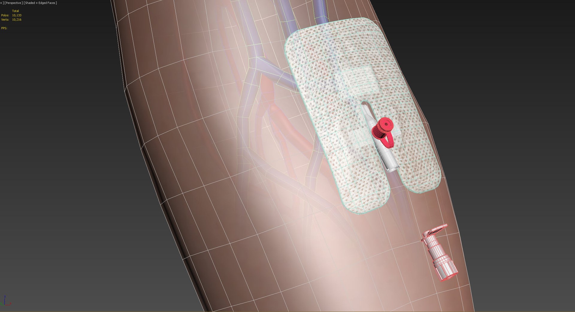 Upper limb Injected Cannula with sticky plaster 3D https://p.turbosquid.com/ts-thumb/qc/nWU4KQ/PP/20230116_155916/jpg/1674210171/1920x1080/fit_q87/d87072b5783e01c9d75b5a6ffeab57390e10a88f/20230116_155916.jpg