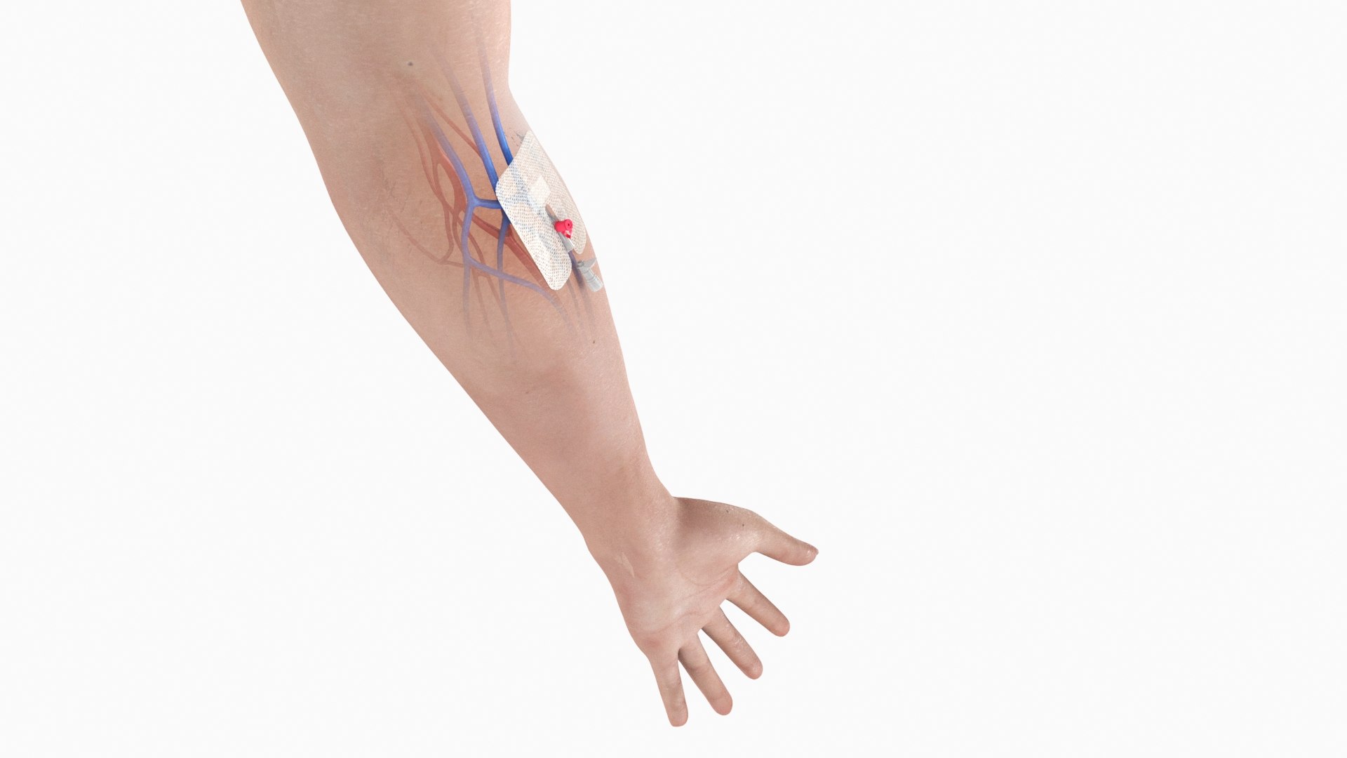 Upper limb Injected Cannula with sticky plaster 3D https://p.turbosquid.com/ts-thumb/qc/nWU4KQ/Vu/stickyplastercannula_arm_03/jpg/1674209870/1920x1080/fit_q87/e6669ed746d1166feb39e101c02049de7edeb644/stickyplastercannula_arm_03.jpg