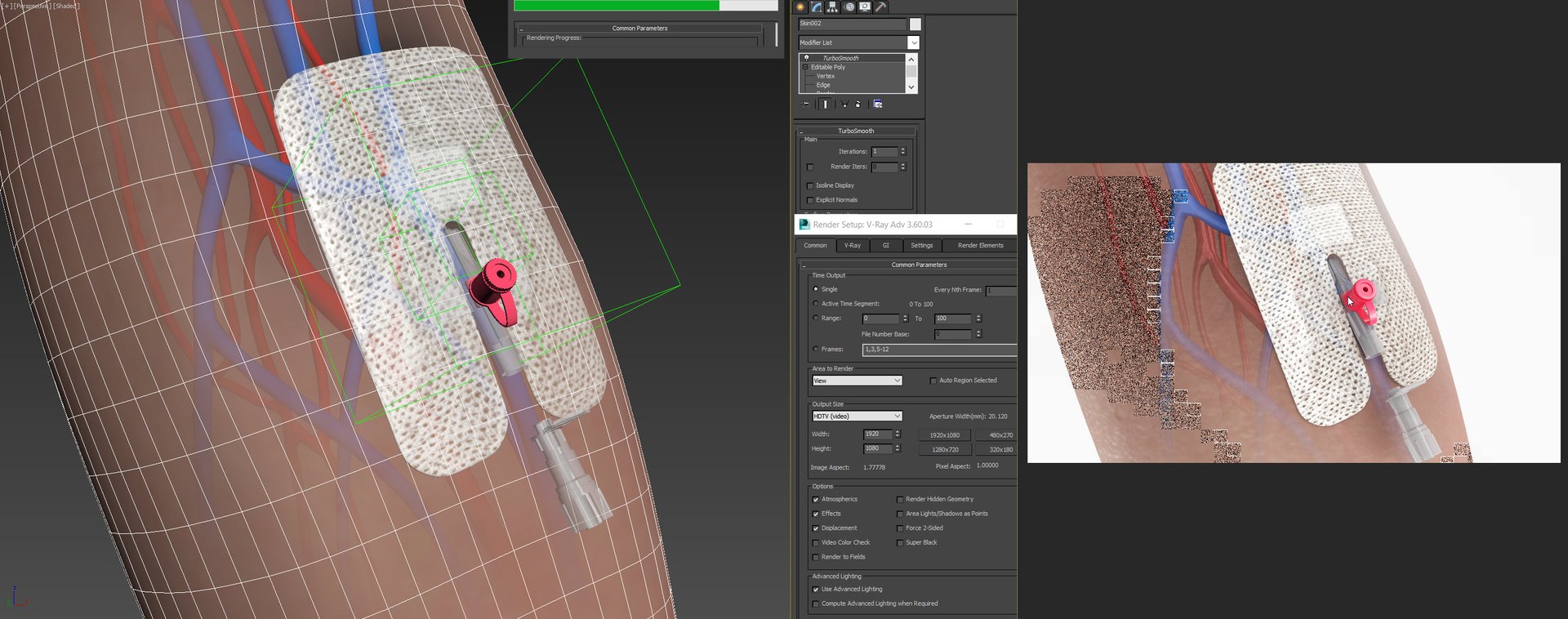Upper limb Injected Cannula with sticky plaster 3D https://p.turbosquid.com/ts-thumb/qc/nWU4KQ/kT/20230116_162901/jpg/1674210170/1920x1080/fit_q87/0e2485ac17b4adc582e1c1882236c9191dd17c9c/20230116_162901.jpg