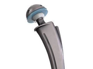 Hip replacement implant and 4 bonus texture