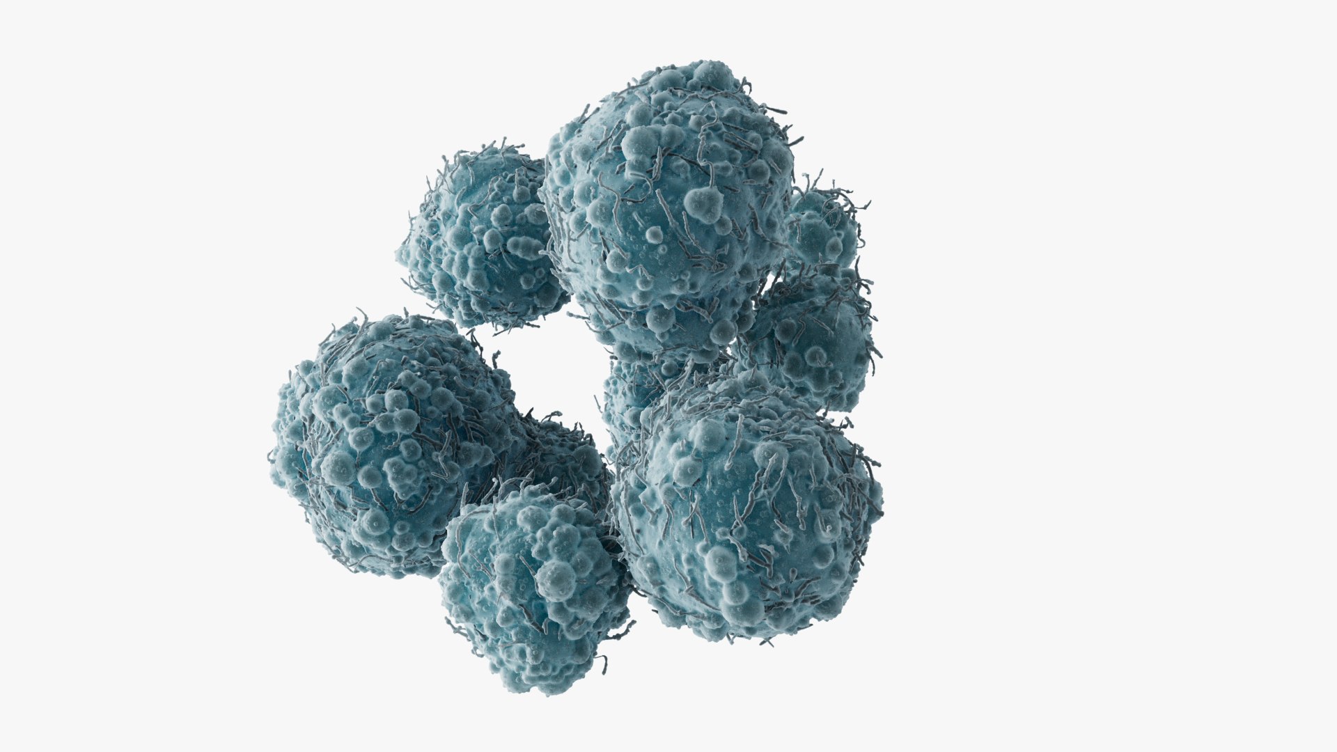 Cancer Cells Brain 2 3D Model - TurboSquid 2225315