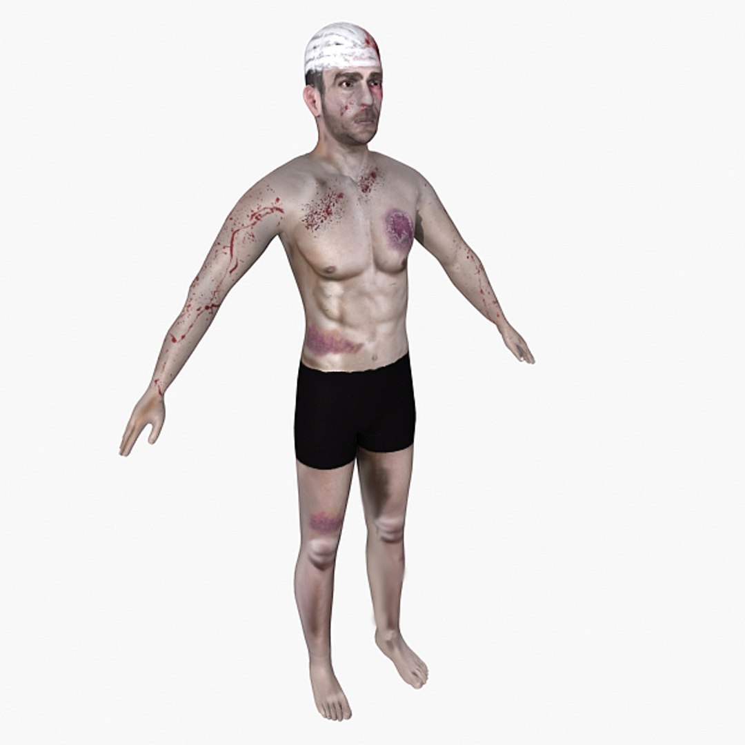 victim patient obj free https://p.turbosquid.com/ts-thumb/r5/010RSs/4cwSdOzI/0004/jpg/1405171406/1920x1080/fit_q87/bde63c0f7752c6f5b9bb1c4befadcadb118fb2ff/0004.jpg
