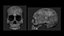 Human Skull - No Jaw - 3D Model - ABB