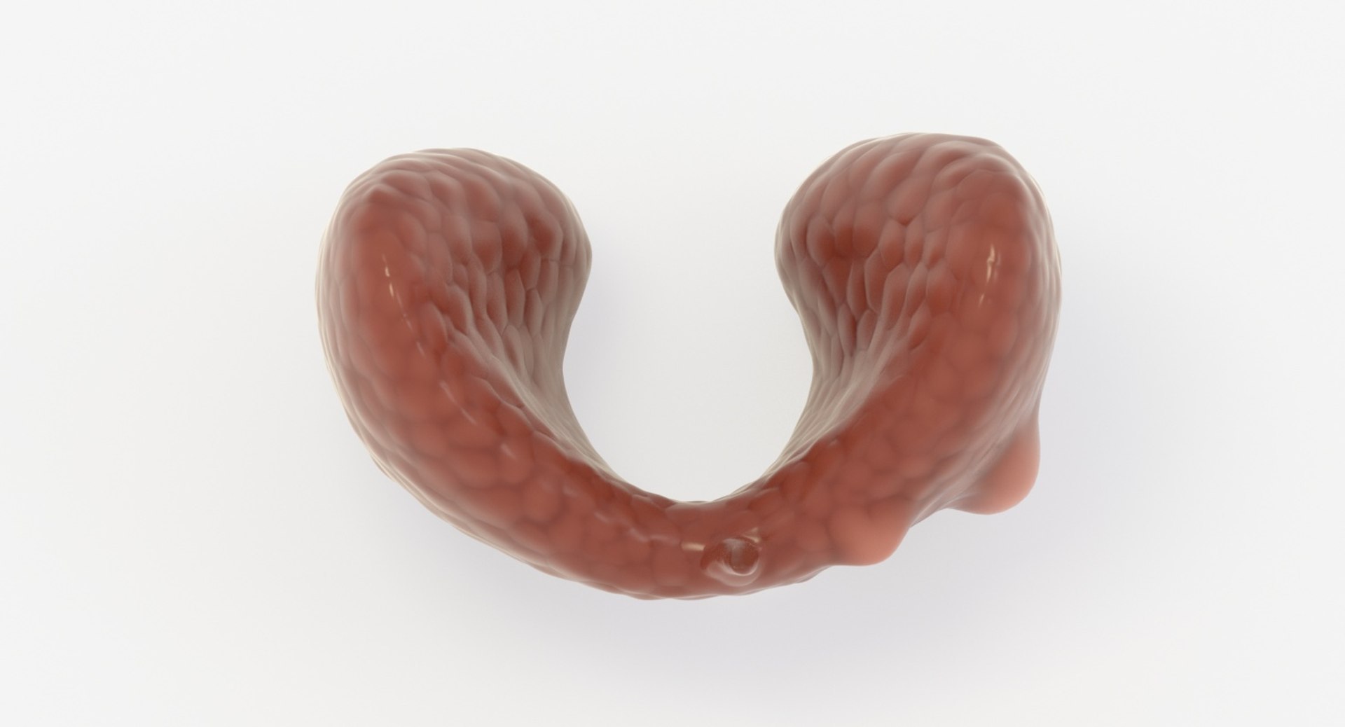 follicular cancer thyroid model https://p.turbosquid.com/ts-thumb/rC/VrYaYj/Gohqn6ef/15_up_view/jpg/1546076773/1920x1080/fit_q87/adbd7c6201634c34f6469e73561ba3558793709b/15_up_view.jpg