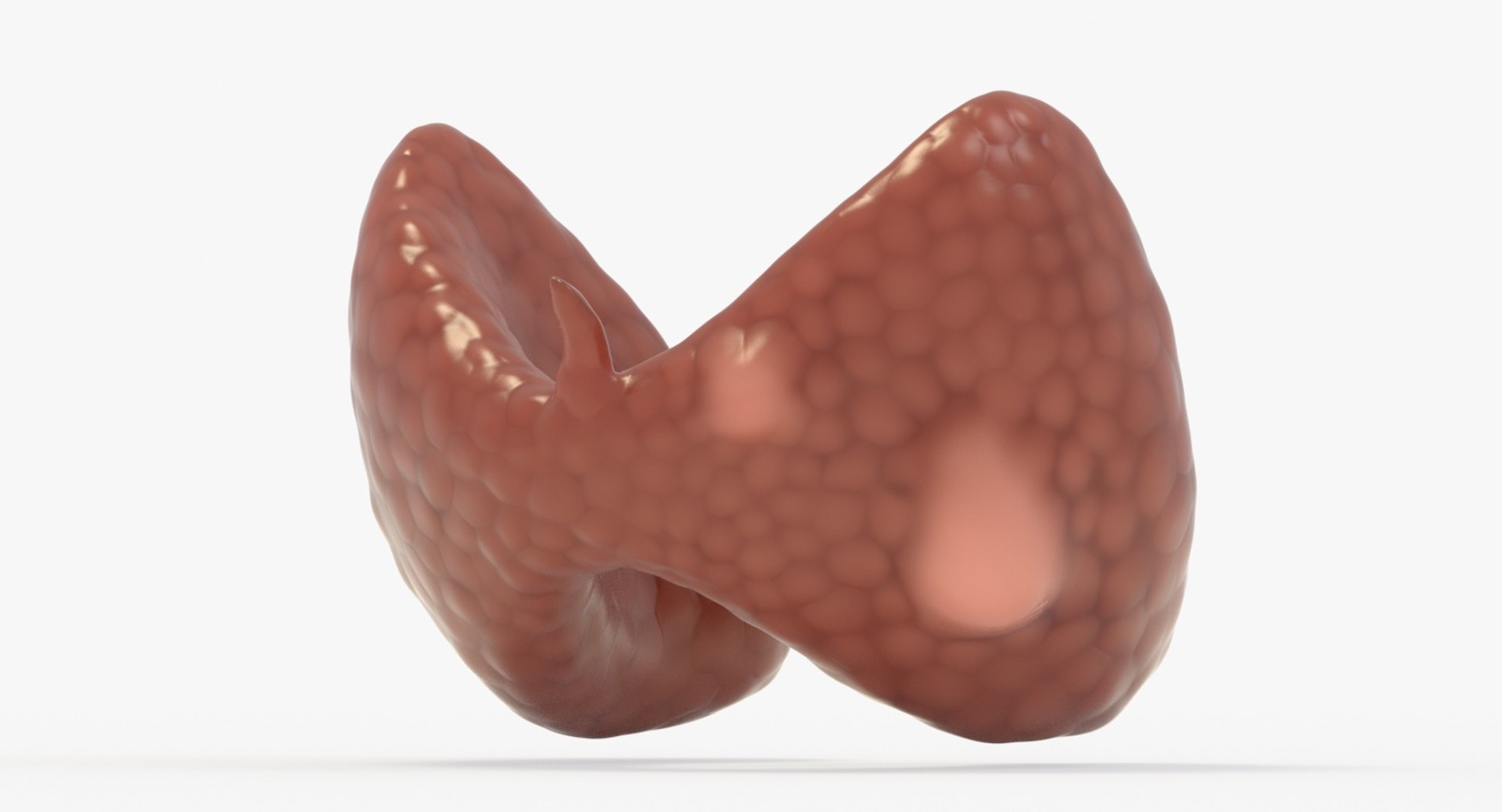follicular cancer thyroid model https://p.turbosquid.com/ts-thumb/rC/VrYaYj/Jj70voFu/11_context_image/jpg/1546076773/1920x1080/fit_q87/d1b68ea721fa9b648ab052cc649d6ae3b22ab660/11_context_image.jpg