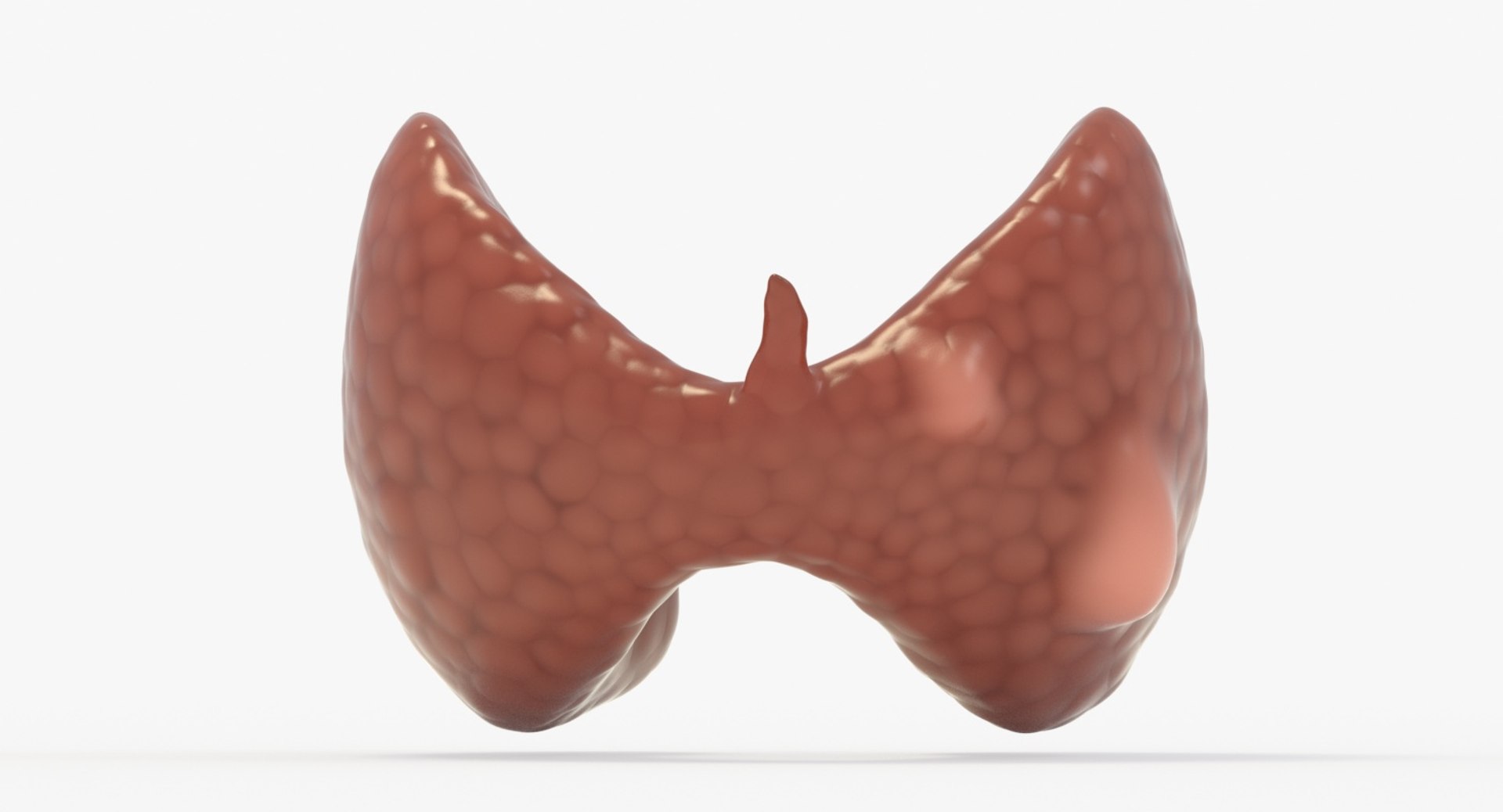 follicular cancer thyroid model https://p.turbosquid.com/ts-thumb/rC/VrYaYj/QH2EhZmK/12_front_view/jpg/1546076773/1920x1080/fit_q87/aa9356ad03f245651fceddb72e17390f9b5f3452/12_front_view.jpg
