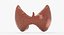 Follicular Cancer Thyroid