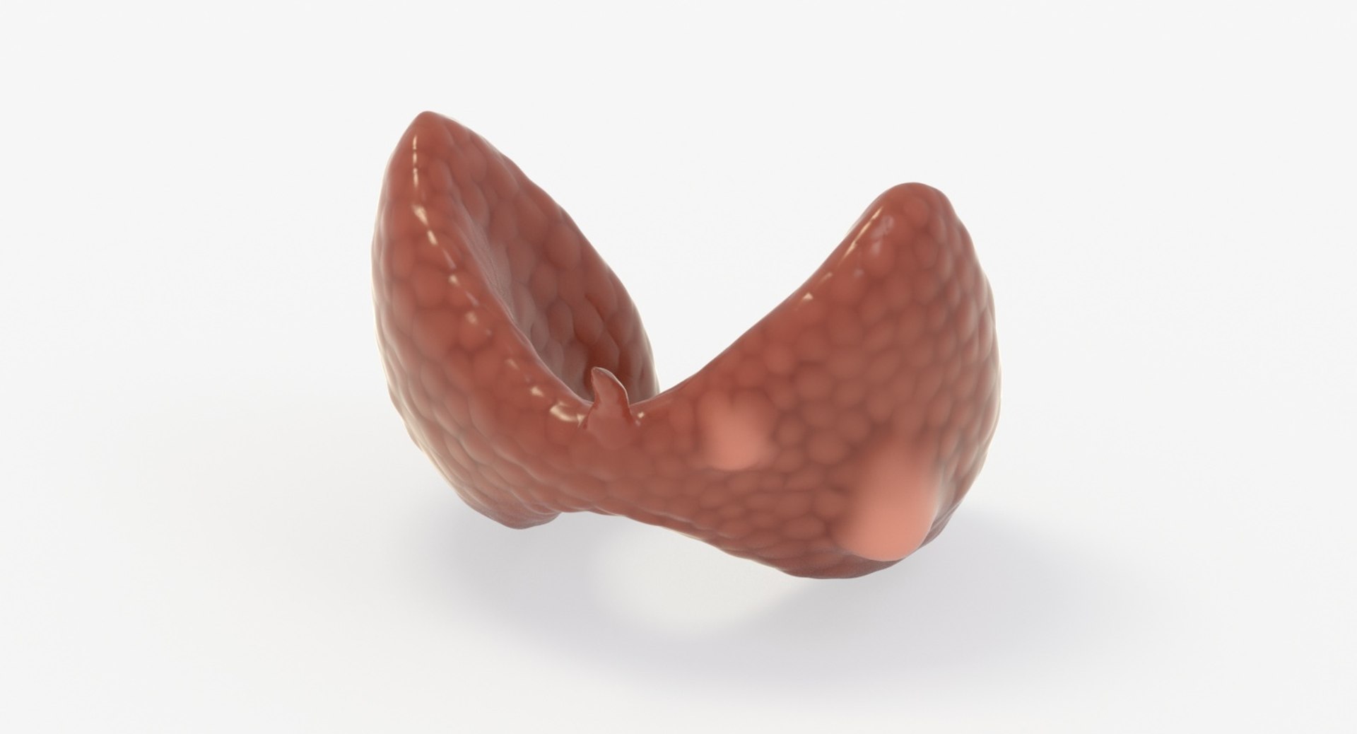 follicular cancer thyroid model https://p.turbosquid.com/ts-thumb/rC/VrYaYj/fwgSbRRm/14_up_view/jpg/1546076773/1920x1080/fit_q87/af58f47ac1939562c28f2bb64307c36eae3ebd62/14_up_view.jpg