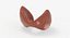 Follicular Cancer Thyroid