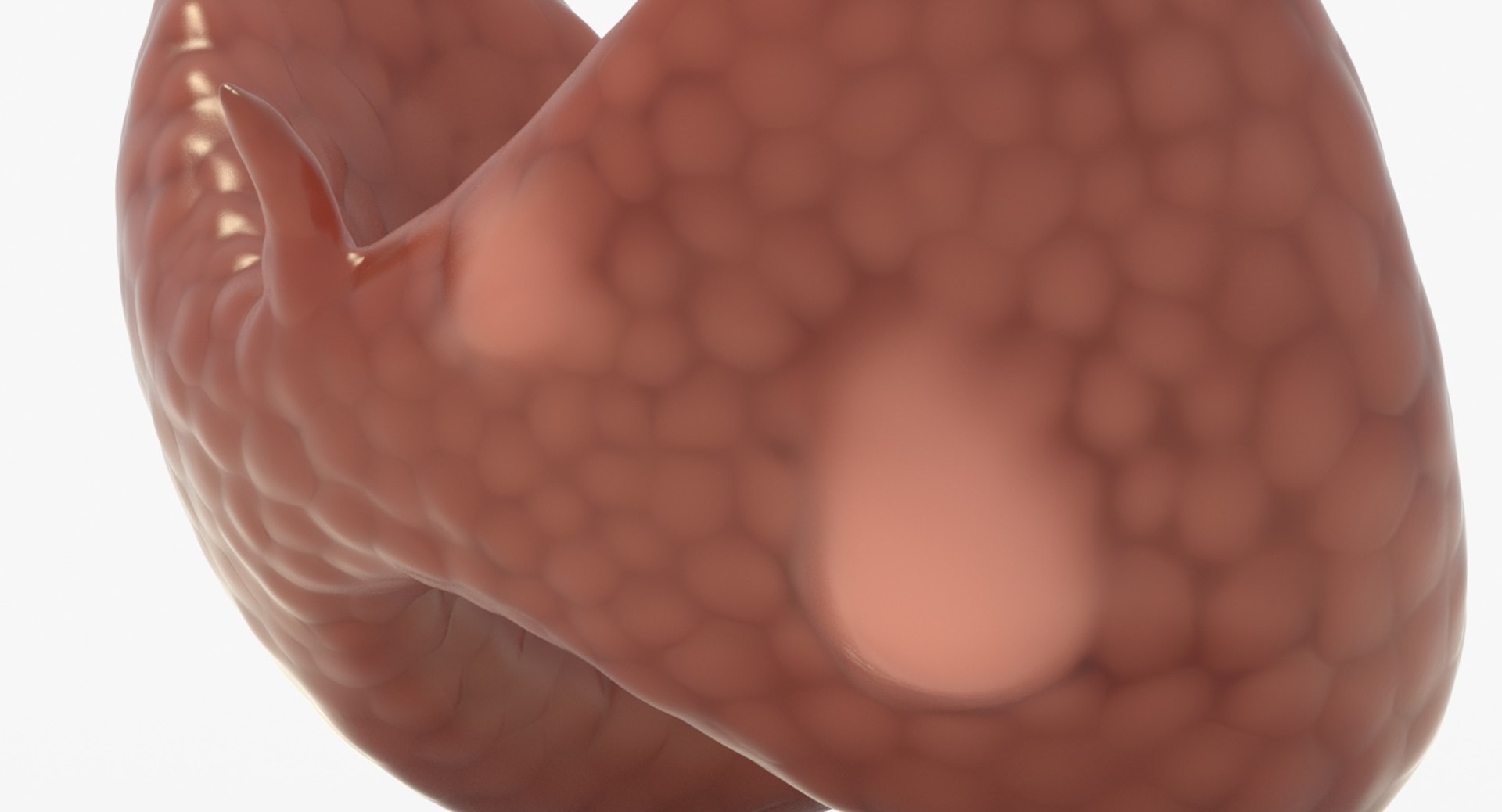 follicular cancer thyroid model https://p.turbosquid.com/ts-thumb/rC/VrYaYj/qOnIsPpQ/16_close_view/jpg/1546076773/1920x1080/fit_q87/f6ab3f054cd0e44ed861380208d6942a19c31364/16_close_view.jpg