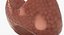 Follicular Cancer Thyroid