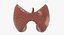 Follicular Cancer Thyroid