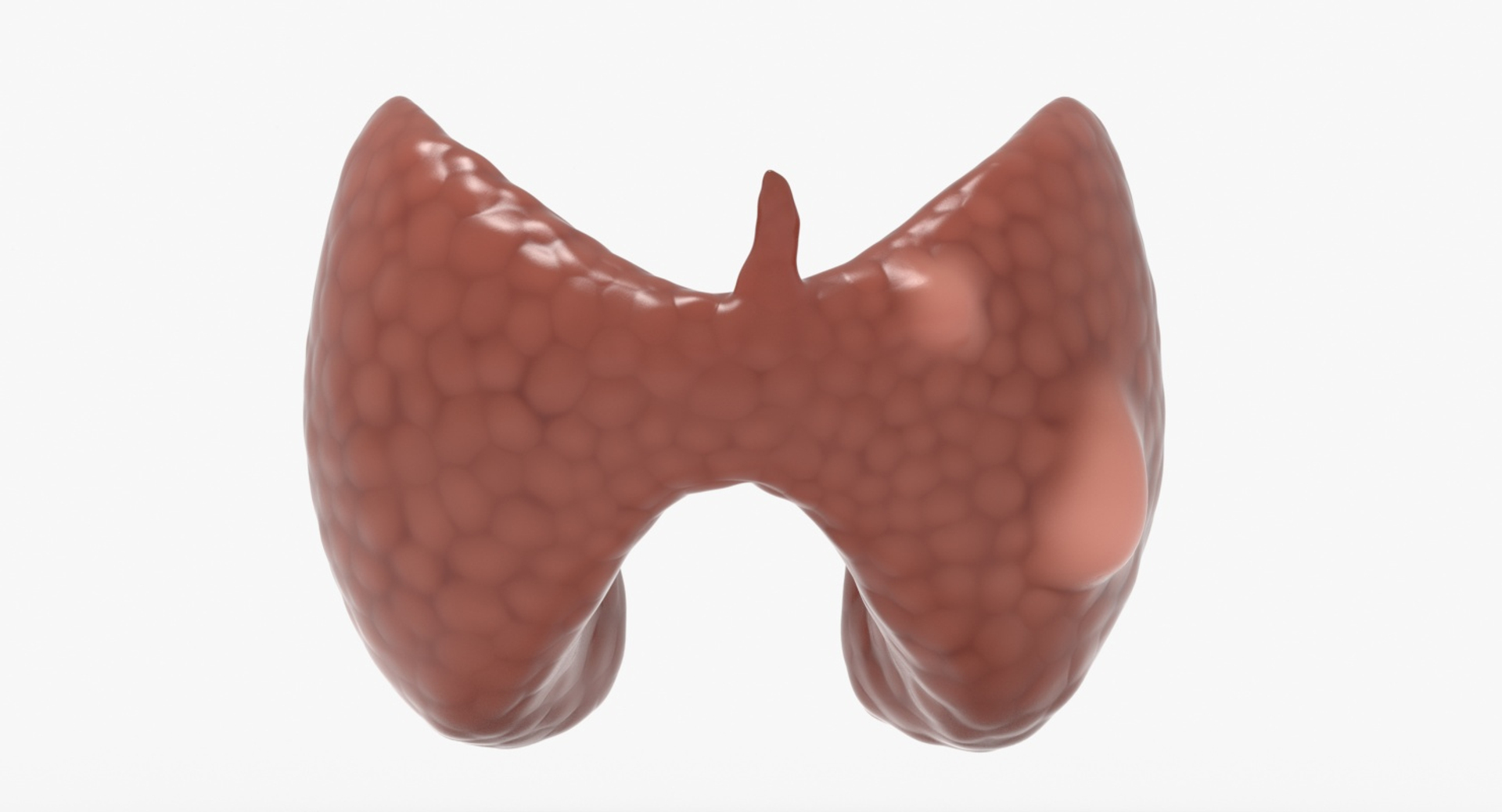 follicular cancer thyroid model https://p.turbosquid.com/ts-thumb/rC/VrYaYj/xw9SKxy1/follicular_cancer_thyroid/jpg/1546076887/1920x1080/turn_fit_q99/5706ad6f7a89648b44954ac23f3d5d120ab0af32/follicular_cancer_thyroid-1.jpg