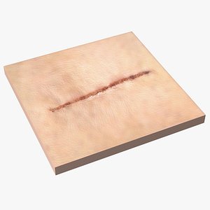 Medical Suture Closed on Skin