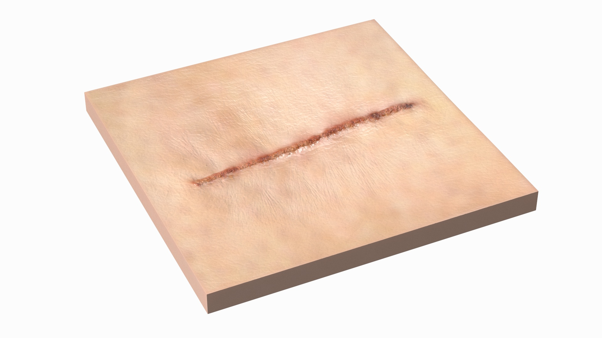 Medical Suture Closed On Skin 3D TurboSquid 2161381