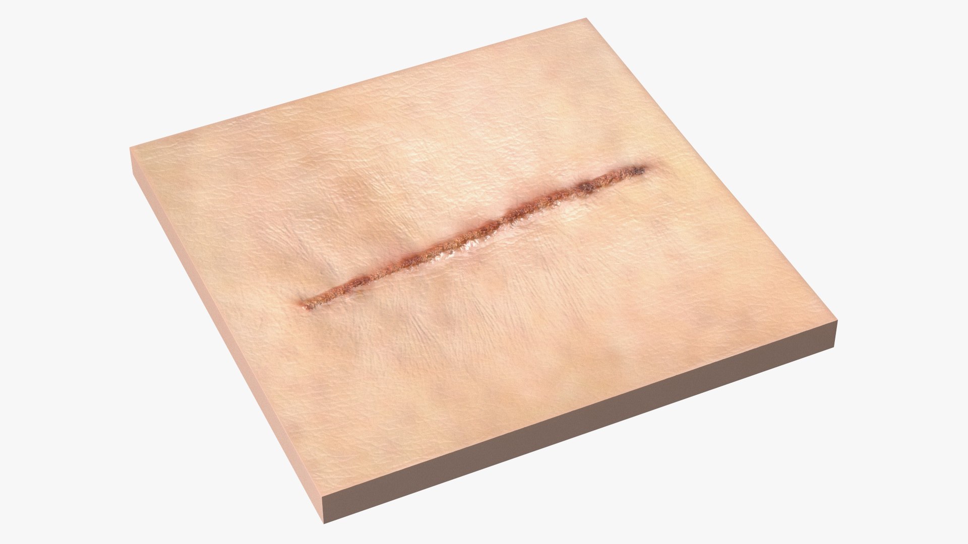 Medical Suture Closed on Skin 3D model preview