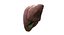 Liver 3D