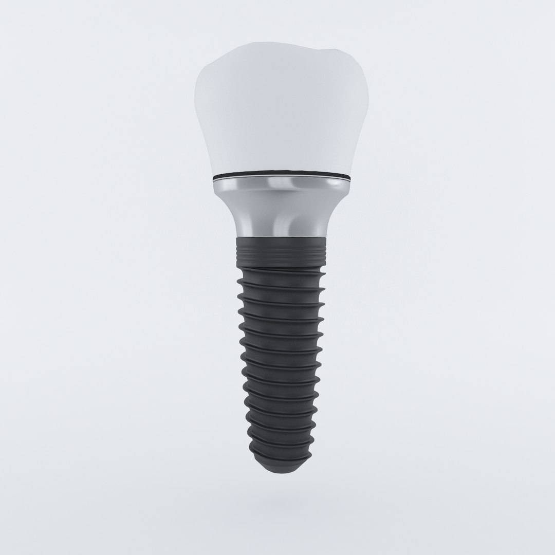 maya dental dent implant