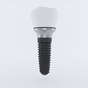 maya dental dent implant