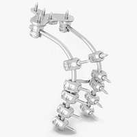 Posterior Cervical Spine Fixation System