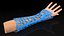 3D-Printed Orthopedic Casts on  Limbs Collection 3D