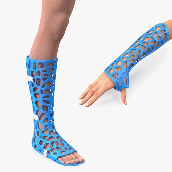 3D-Printed Orthopedic Casts on Limbs Collection 3D