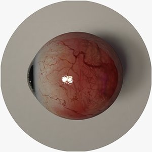 Eyeball - anatomic based