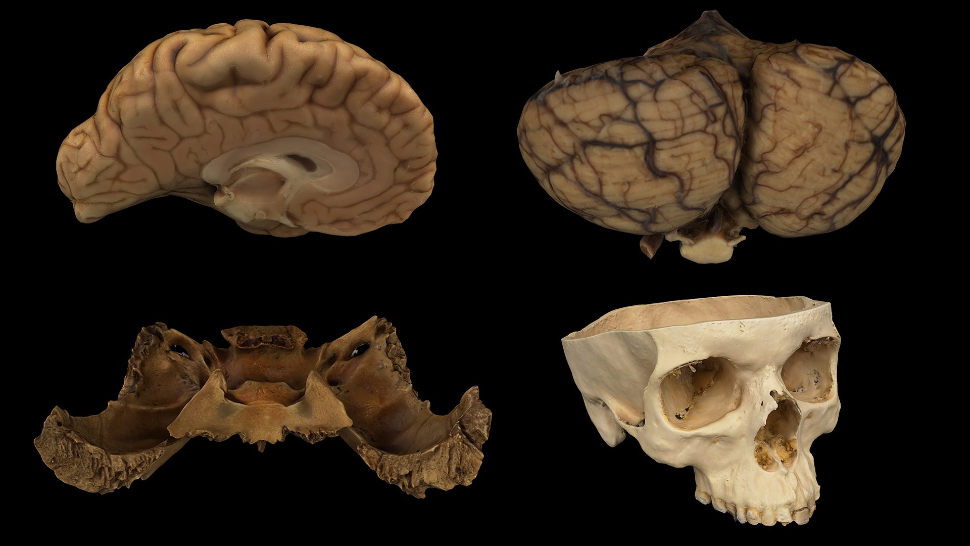3D Medical Collection BrainSkull 04 https://p.turbosquid.com/ts-thumb/sG/3f2nvo/2P/collection04/jpg/1699347875/1920x1080/fit_q87/5f5d36e620ad8a3c6dd290c8874382fc28e50458/collection04.jpg