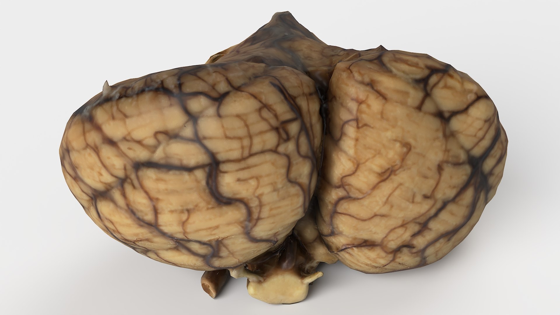 3D Medical Collection BrainSkull 04 https://p.turbosquid.com/ts-thumb/sG/3f2nvo/LI/cerebellum01_03/jpg/1698409810/1920x1080/fit_q87/893c1b8dbb45a84ba628a606a4235337d4a37bdb/cerebellum01_03.jpg