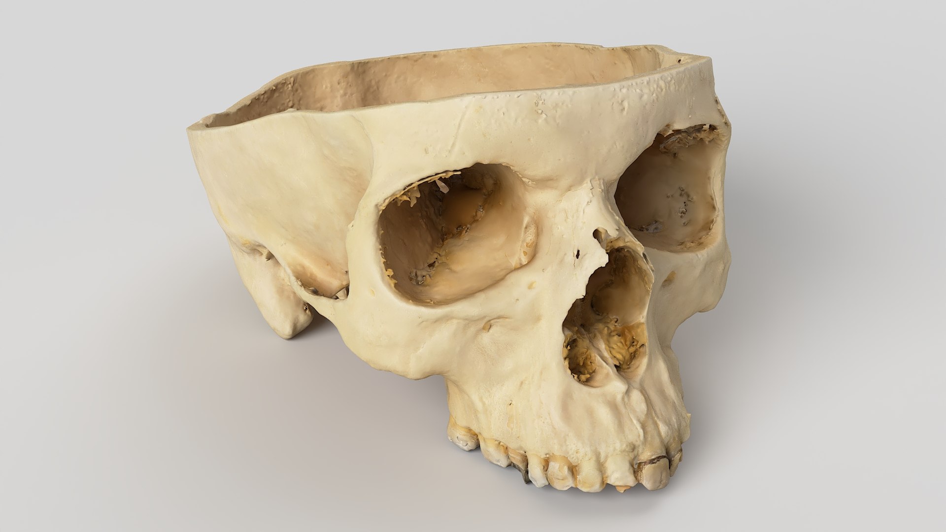 3D Medical Collection BrainSkull 04 https://p.turbosquid.com/ts-thumb/sG/3f2nvo/Mz/skull_03/jpg/1698395524/1920x1080/fit_q87/f8d5aee37dd4909b34233ecd23f2eba9862a3f13/skull_03.jpg
