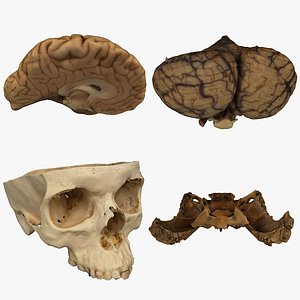 Medical Collection BrainSkull 04