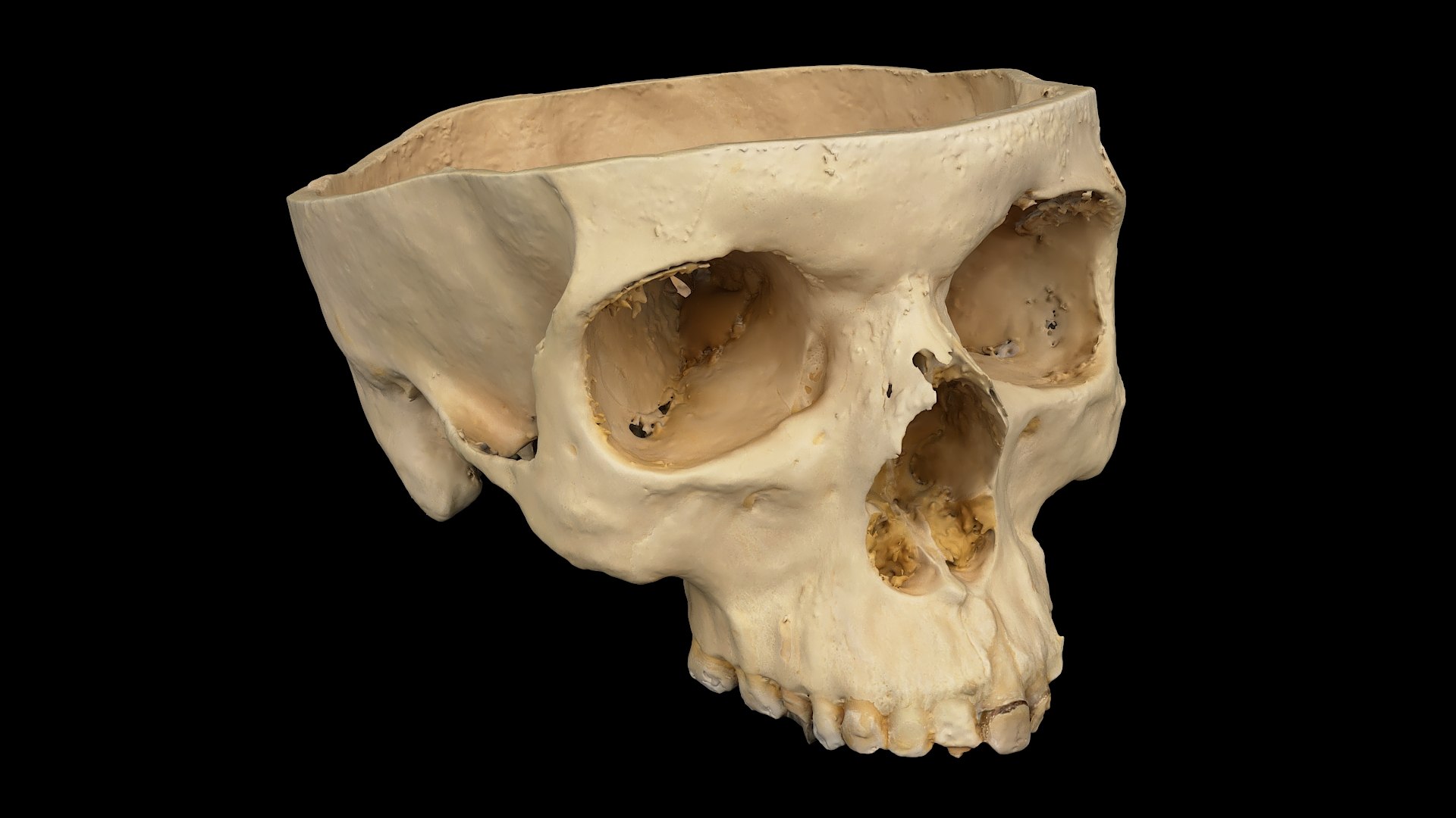 3D Medical Collection BrainSkull 04 https://p.turbosquid.com/ts-thumb/sG/3f2nvo/yL/skull_02/jpg/1698395523/1920x1080/fit_q87/d1f569e8e4b505f95fda10253a779dfd91a00670/skull_02.jpg