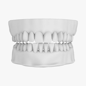 Plaster Teeth Dentures