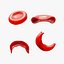 3D model Cross Section of Normal vs Sickle Red Blood Cell