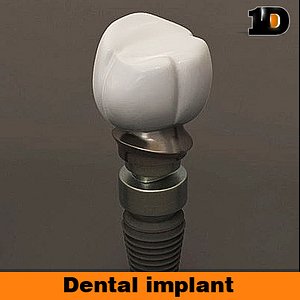dental implant lwo