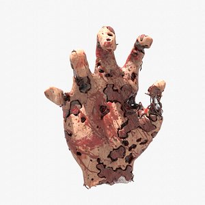 Infected Hand