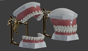Dental Prosthesis