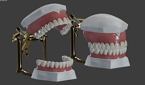 Dental Prosthesis