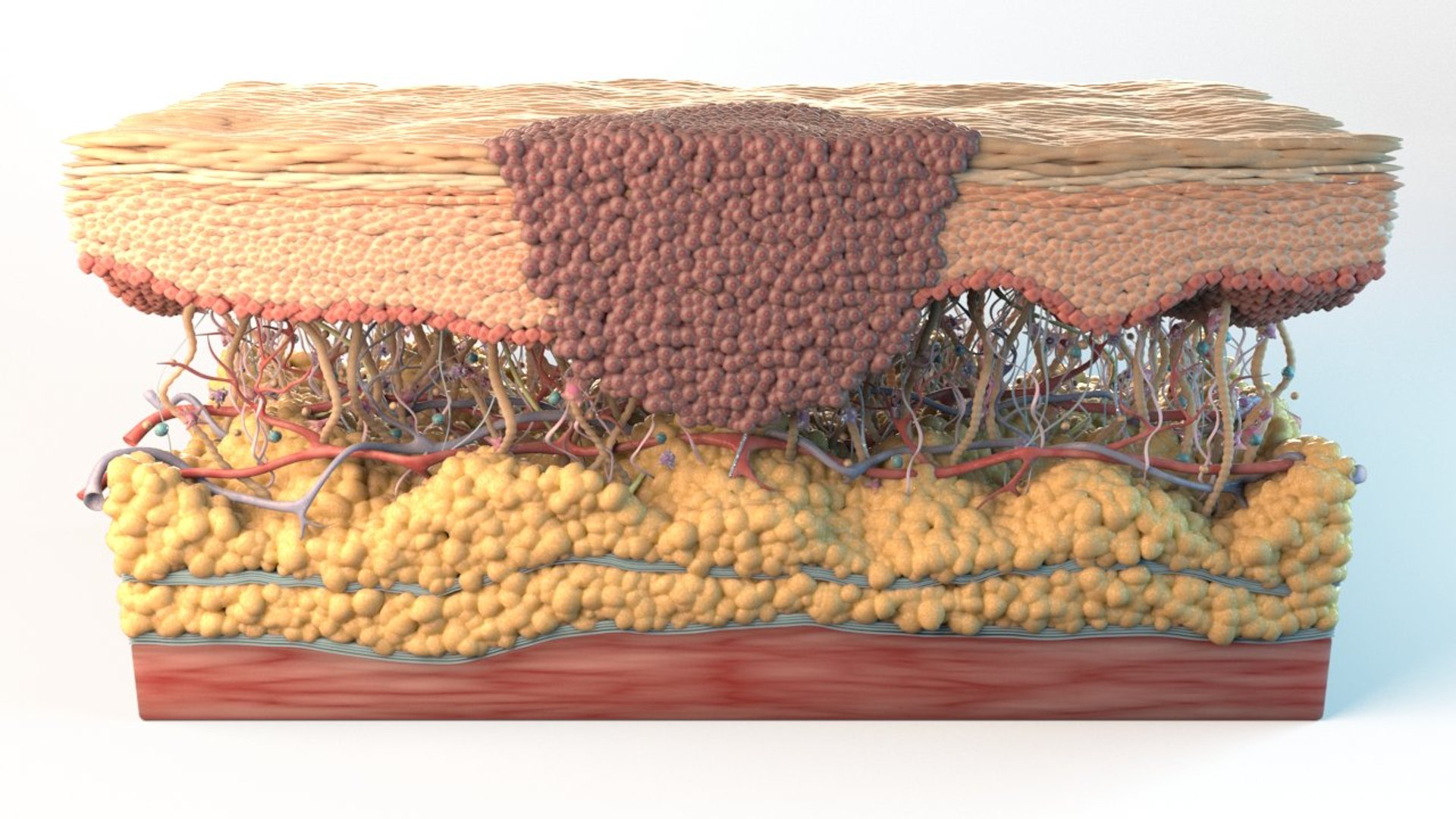 3D skin cancer cells https://p.turbosquid.com/ts-thumb/sy/zEIijm/JjojAsjq/skin_cross_section_carcinoma_cells_r_.rgb_color.0000/jpg/1559584596/1920x1080/fit_q87/20d47e0d391cd685e953ca1c290d2cdbaed49213/skin_cross_section_carcinoma_cells_r_.rgb_color.0000.jpg