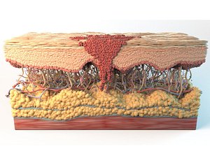 Skin Cancer Cells