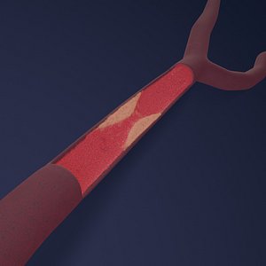 Artery with atherosclerotic plaque