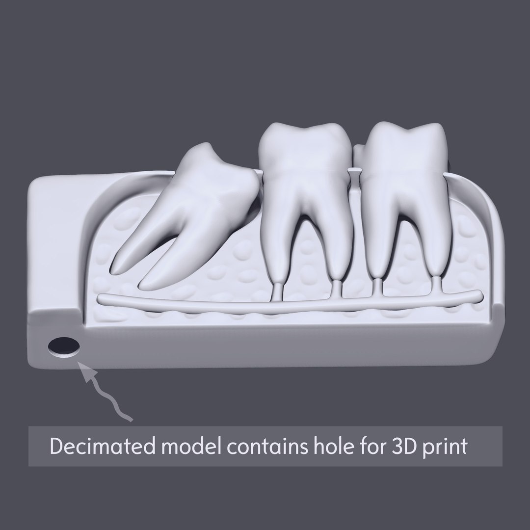 3D wisdom impaction tooth https://p.turbosquid.com/ts-thumb/tW/2ePjhg/CQbWJuHT/08/jpg/1573738877/1920x1080/fit_q87/428d0f10014a3f08127b1df74fd856043df7a649/08.jpg