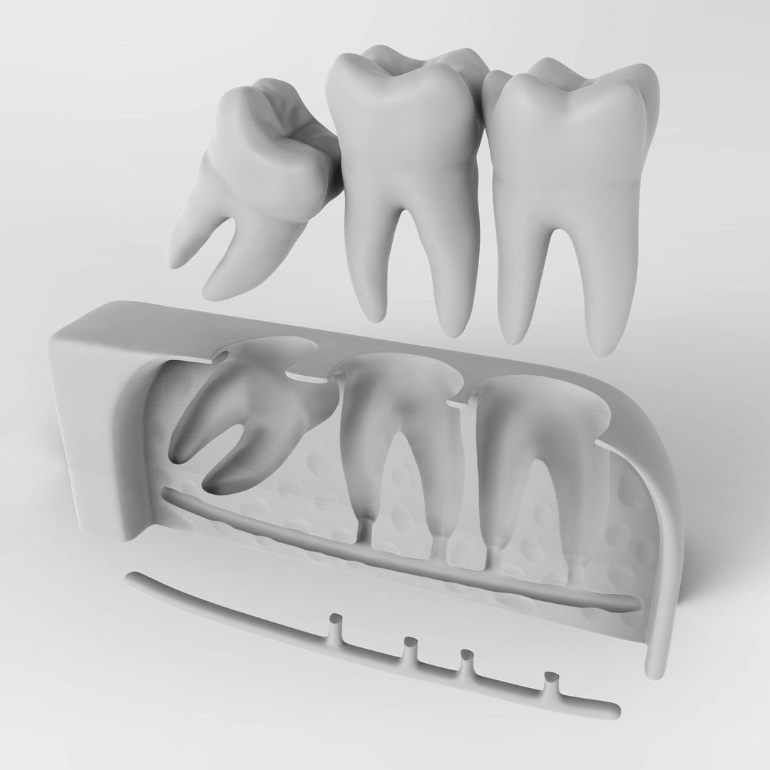 3D wisdom impaction tooth https://p.turbosquid.com/ts-thumb/tW/2ePjhg/UsWmB7PR/09/jpg/1573732498/1920x1080/fit_q87/39c50f912a0bc57a4414eae5a38a416c71b34ed6/09.jpg
