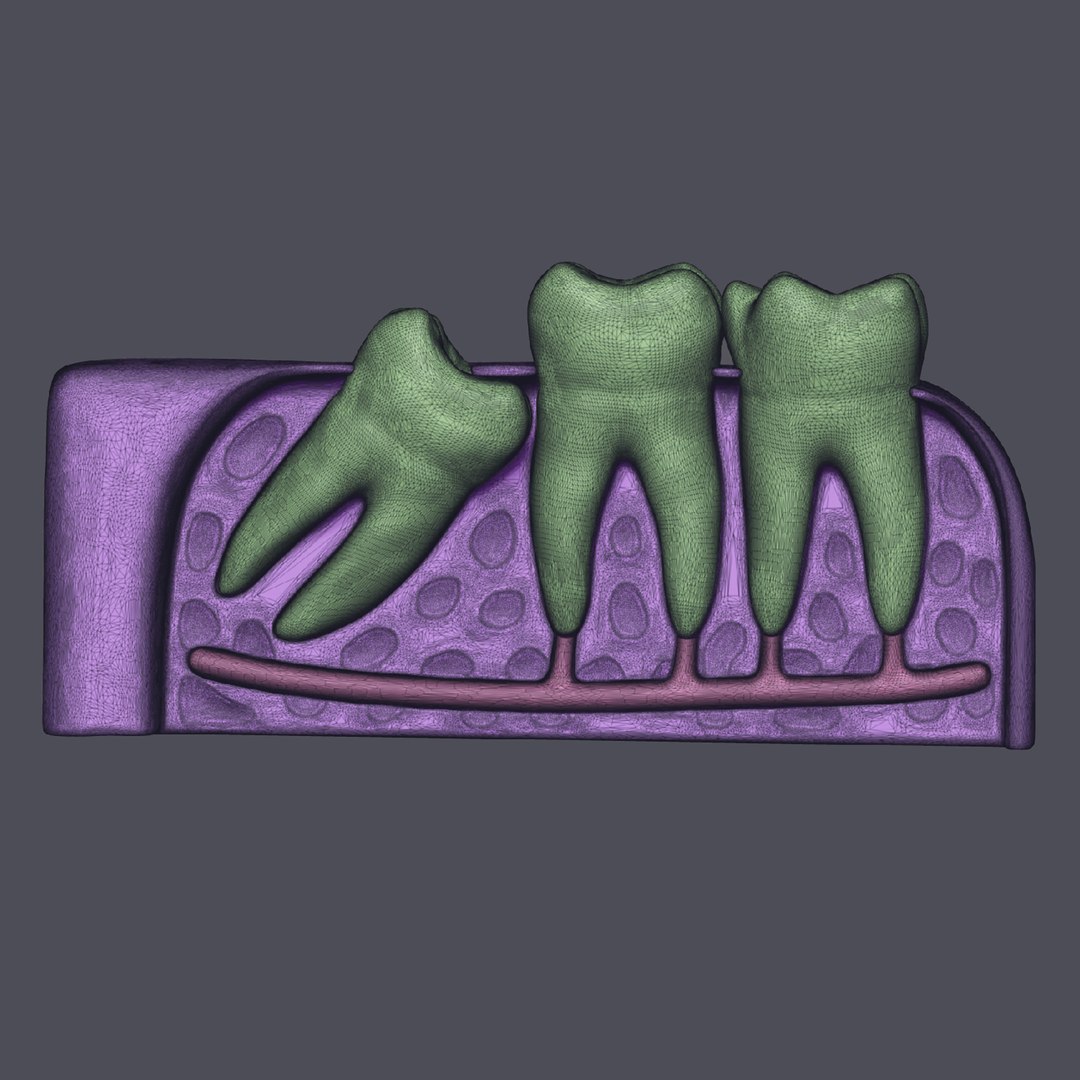 3D wisdom impaction tooth https://p.turbosquid.com/ts-thumb/tW/2ePjhg/xG3JBIqW/10/jpg/1573732509/1920x1080/fit_q87/4443737a9e1cfb366c24a98fd338e4aef216a523/10.jpg