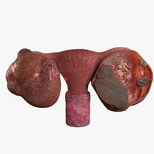 ovary mucinous cystic tumor