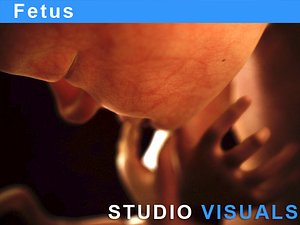 3ds max fetus