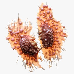 Cancer Cell Tumor