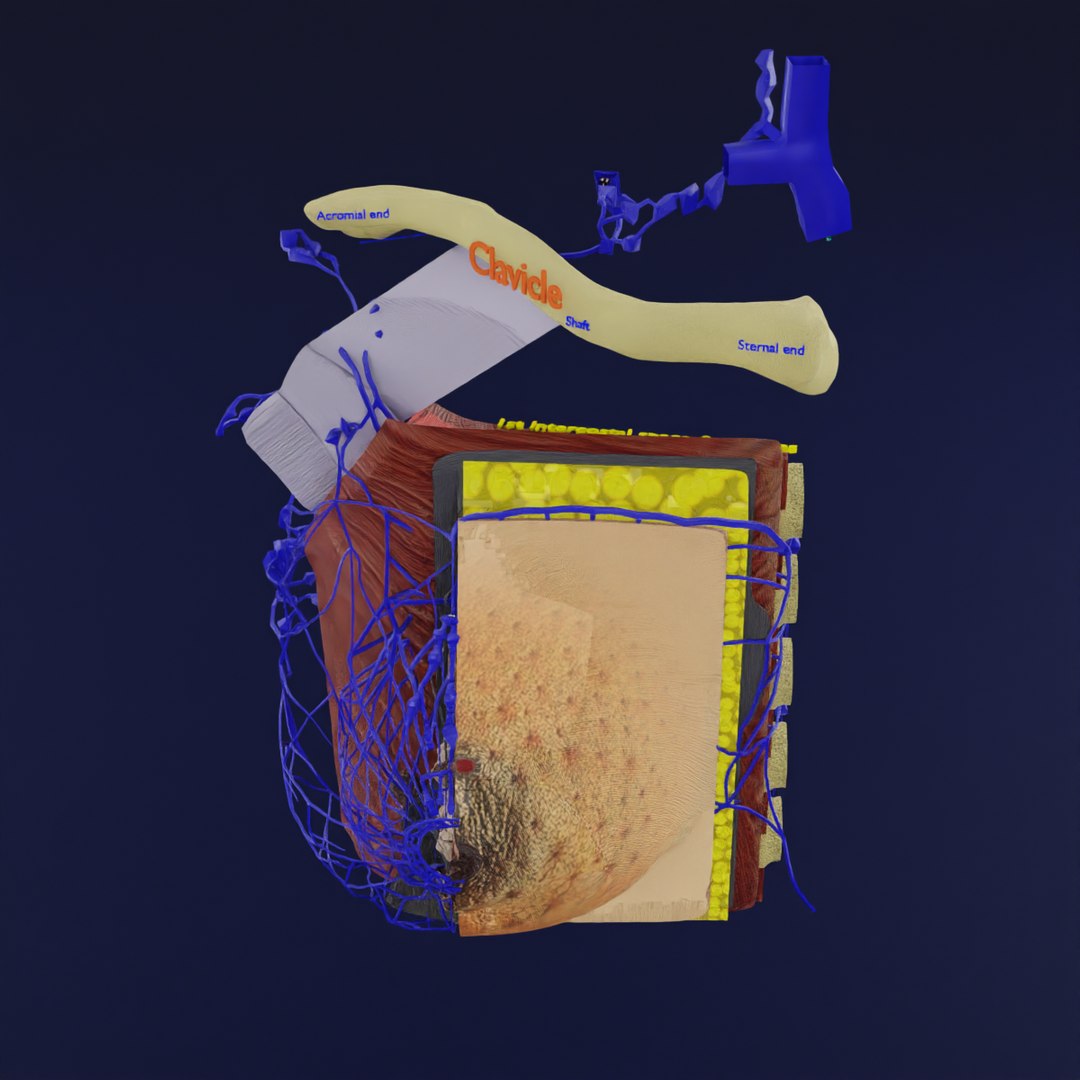 3D breast cancer sketchfab model - TurboSquid 2055853