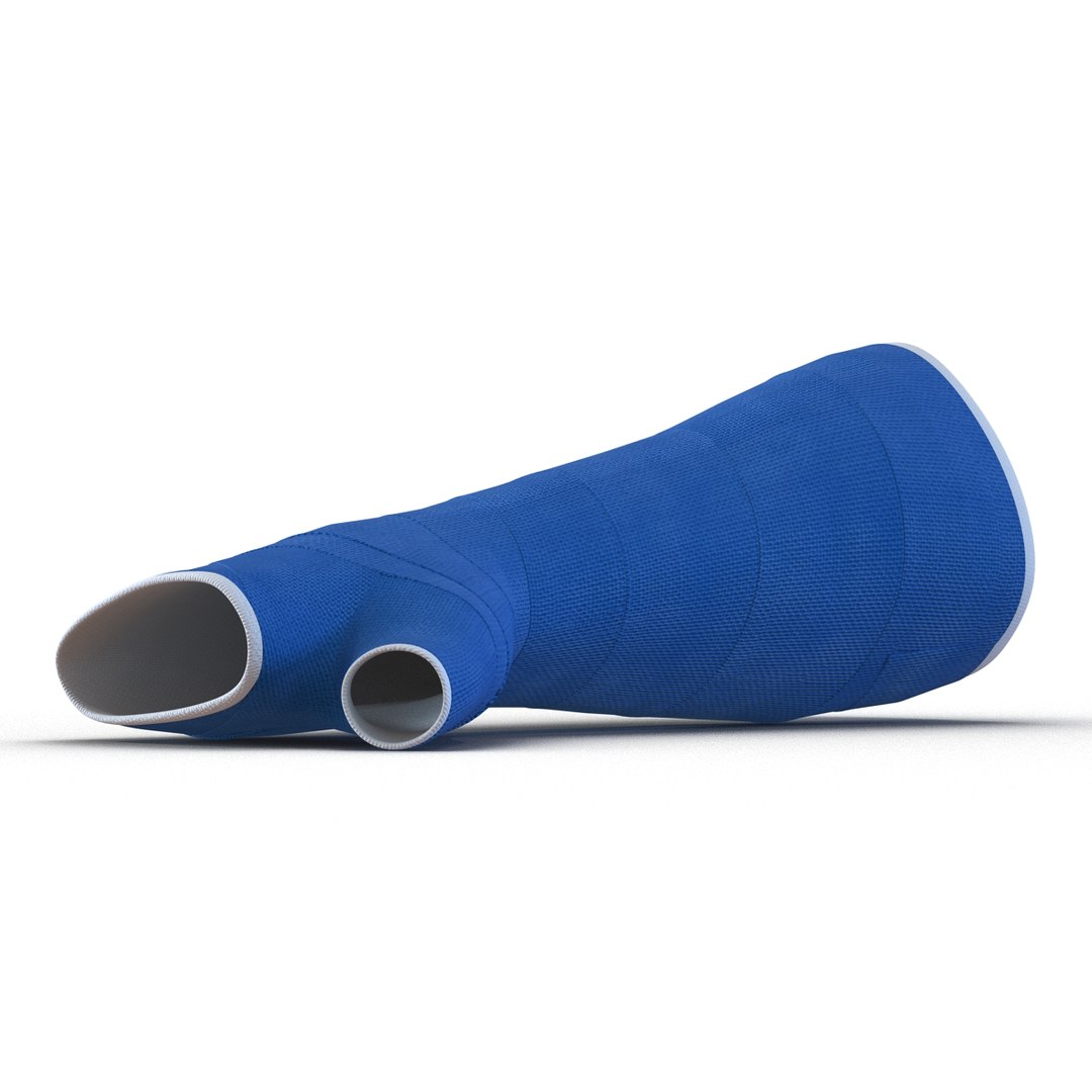 3d blue fiberglass cast arm