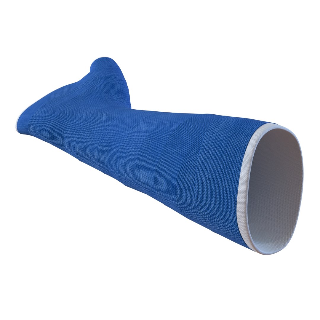 3d blue fiberglass cast arm